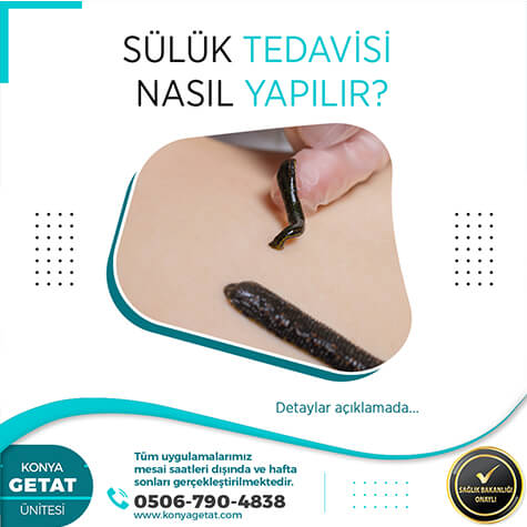 Sülük Tedavisi Fiyatı Ne Kadar?